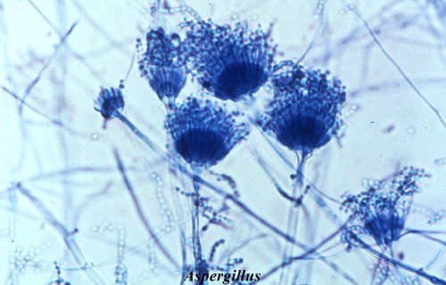 Aspergillus