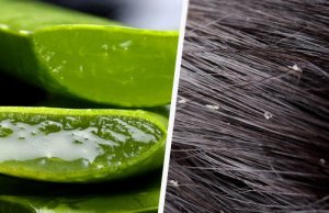 Effectieve en makkelijke manieren om van roos af te komen