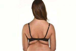 Simpele oefeningen om van vet op de rug af te komen