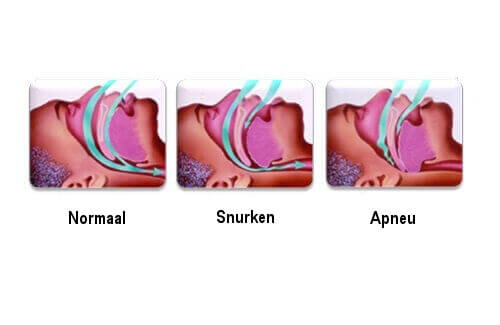 Weetjes over snurken die je aandacht zullen trekken