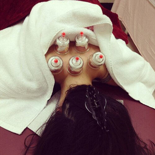 Cupping