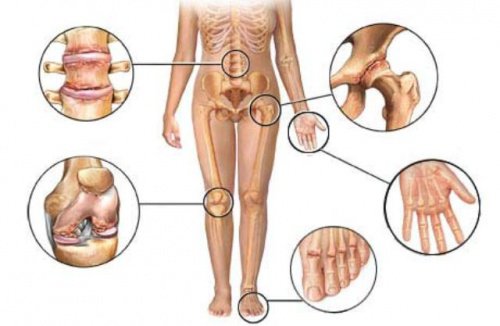 Pijn van artritis verlichten met deze 8 kruiden