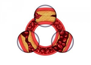 3 cholesterolverlagende middelen met haver