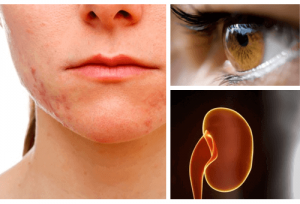 Welke organen lijden het meest onder stress?