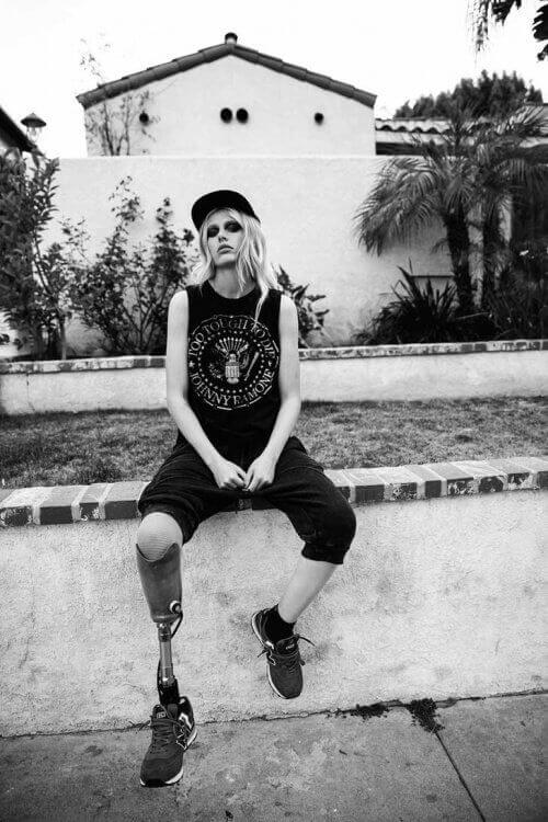 Lauren Wasser model verliest been door tampon