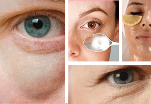 Simpele tips tegen wallen onder de ogen