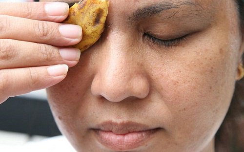 Bananenschil tegen mee-eters en puistjes
