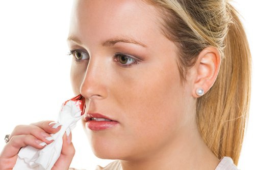 Natuurlijke middelen tegen neusbloedingen