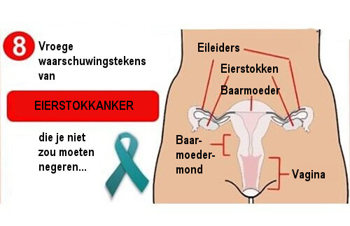 Eierstokkanker