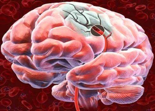 Hoe de bloedtoevoer naar de hersenen te verbeteren