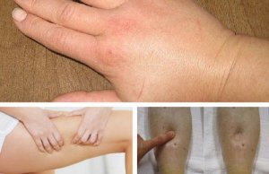 Acht natuurlijke vochtafdrijvende middelen