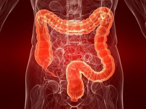 Colitis ulcerosa: oorzaken en behandelingen