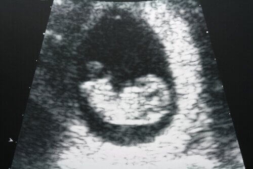 Foto van baby in baarmoeder