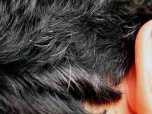 Zes huismiddelen tegen vroegtijdige grijze haren