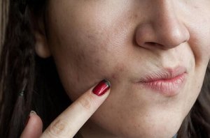 8 voedingsmiddelen voor een zuivere huid