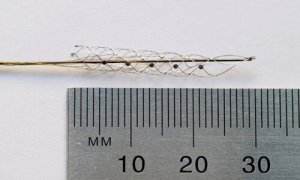 ‘Bionische ruggengraat’: weer lopen met verlamming