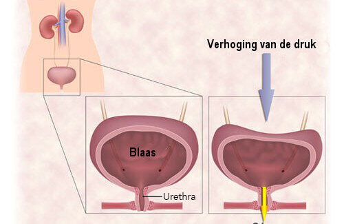 Druk op de blaas