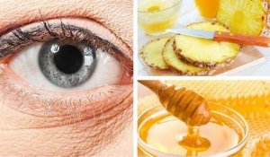 Een natuurlijk ananasmasker voor rimpels onder je ogen