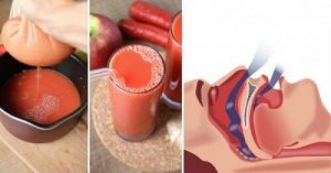 Natuurlijke remedie om snurken tegen te gaan