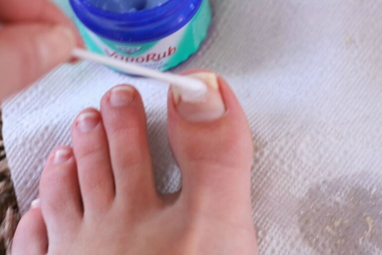 VapoRub tegen Voetschimmel