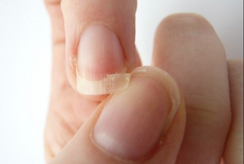 Negen redenen waarom je nagels breken