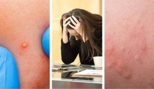 7 tekenen dat je stressniveau te hoog is