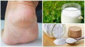 Zachte voeten door slechts twee natuurlijke ingrediënten