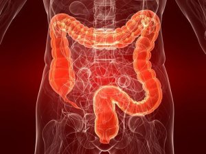 Ulceratieve colitis: een nog onbekende ziekte