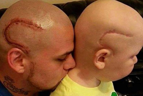 Vader laat tattoo zetten van litteken van zoons operatie