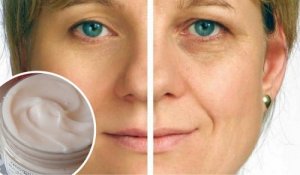 Verminder rimpels met deze zelfgemaakte anti-rimpelcrème