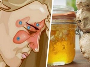 Combineer deze ingrediënten om sinusitis te verzachten