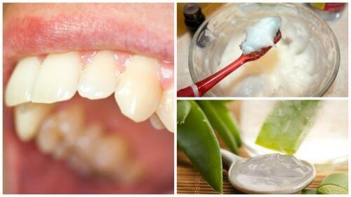 Bestrijd tandplak met deze natuurlijke remedies