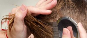 7 natuurlijke manieren om van hoofdluis af te komen