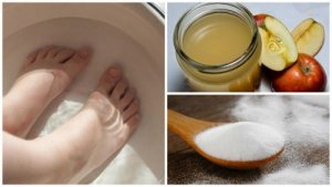 Slechts twee ingrediënten om van nagelschimmel af te komen