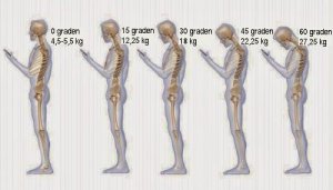 Zes gewoontes die nekpijn veroorzaken