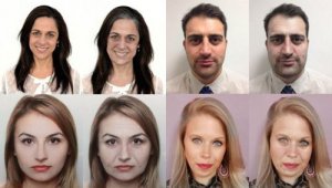 Tien negatieve gevolgen die stress kan hebben voor je uiterlijk