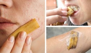 11 tips om bananenschil te gebruiken - gooi ze niet langer weg!
