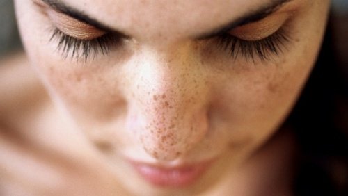 Sproeten verminderen met 6 natuurlijke middelen