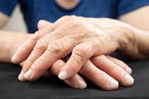 Nieuwe methode om artritis te behandelen