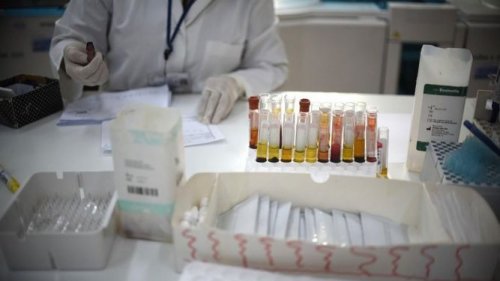 Laboratoriumonderzoek