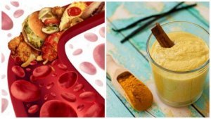 De vijf beste ingrediënten om verstopte slagaderen te reinigen