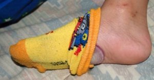 4 voordelen van slapen met uien op je voeten