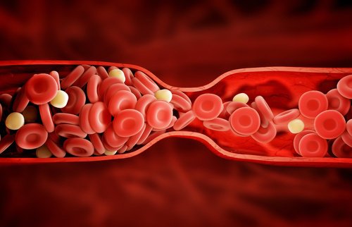 Een ongelofelijke nieuwe behandeling voor 'slecht' cholesterol