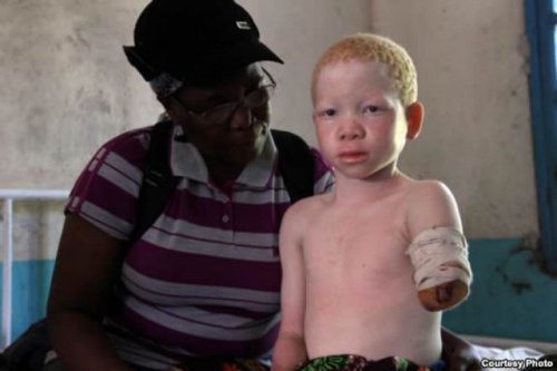 Kind zonder arm