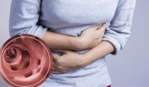 Hoe kom je af van diverticulitis?