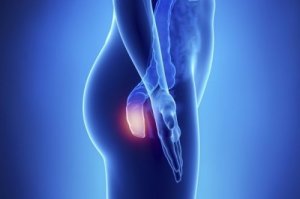 Vijf symptomen van anuskanker