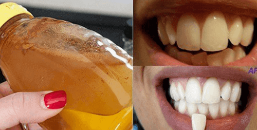 Witte tanden met een volledig natuurlijk product