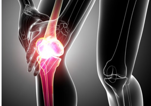 Tendinitis