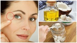 Voorkom kraaienpootjes met deze nachtcrème