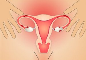 Vijf natuurlijke tips tegen endometriose